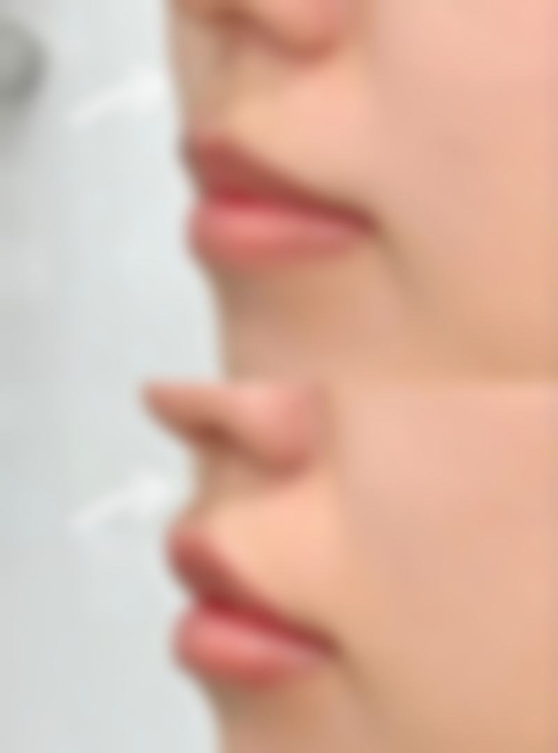 韩国休美整形外科擅长项目