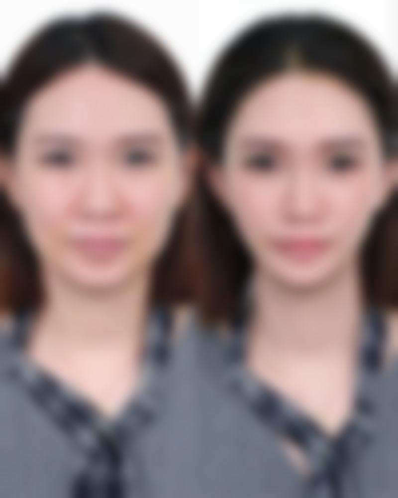 宜昌市第一人民医院(烧伤整形外科)2026年价格收费表: