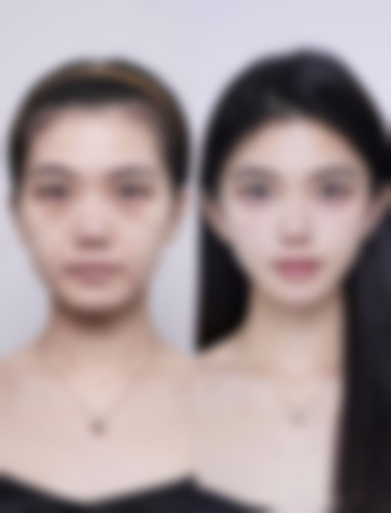 合肥链爱医疗美容牛奔医生擅长项目