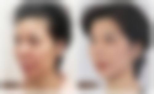 奥拉克皮肤医学美容医院预约挂号方式。