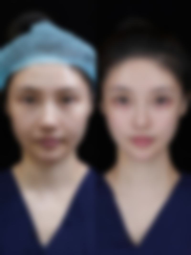 肇庆华美医疗整形医院预约挂号
