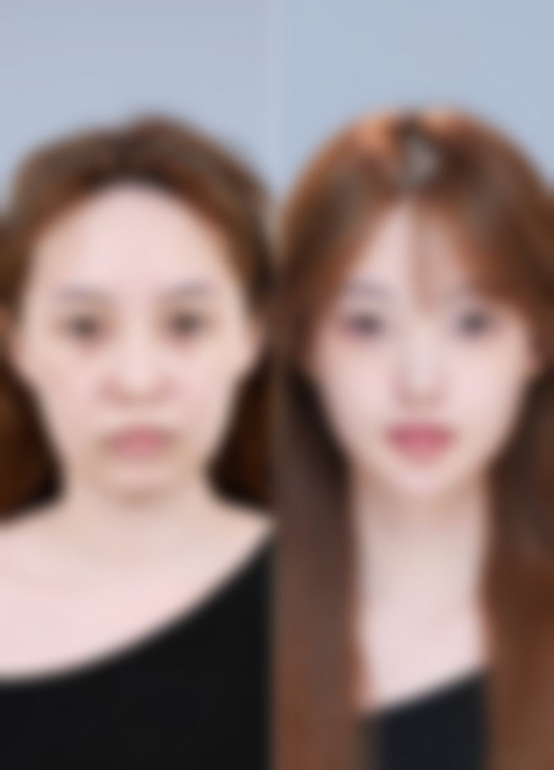 浙江绿城医院整形中 心收费价格表