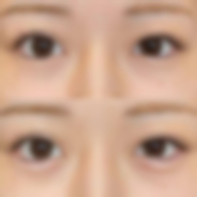 西安熙美医疗美容诊所收费价格表