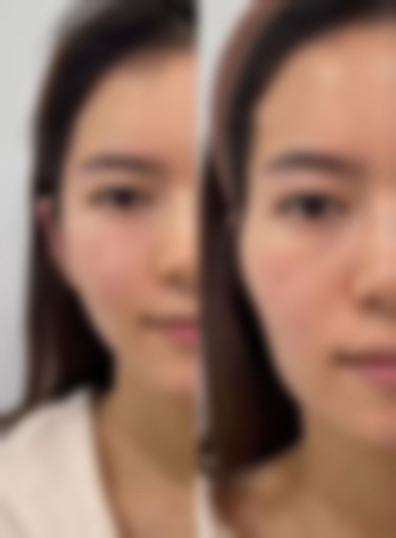 广州皇佳贝丽医疗美容门诊部雷义波医生口碑评价与项目分享: