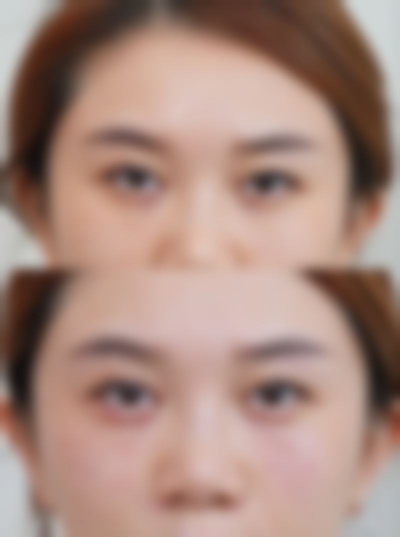 北京中大中医医院皮肤胎记科上班时间: