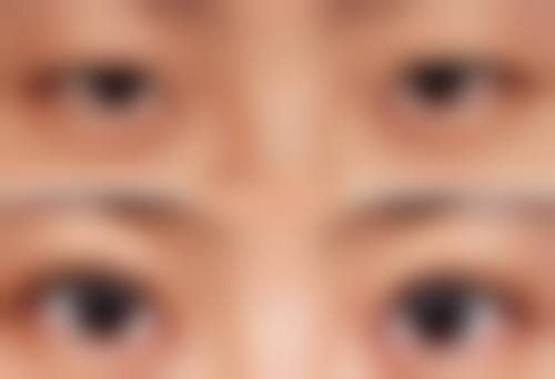 西安寰美颜控医疗美容诊所擅长项目。