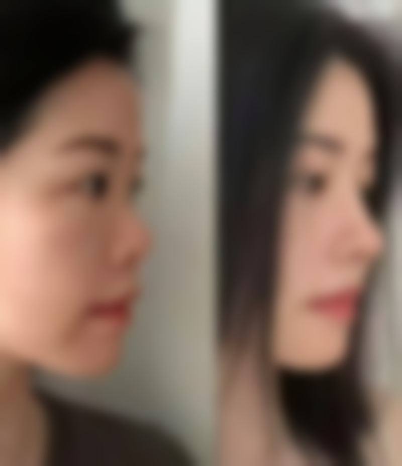 宁德市闽东医院烧伤整形外科口碑评价与项目分享