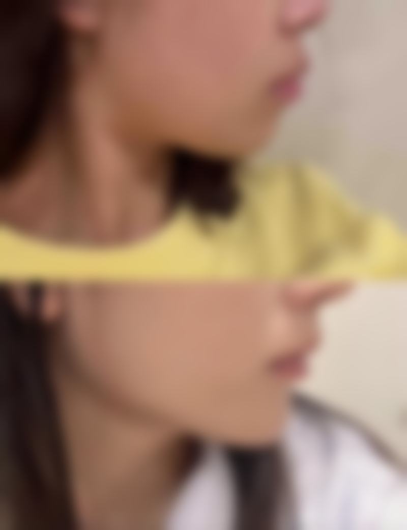 武汉格格屋医疗美容门诊部口碑评价与项目分享: