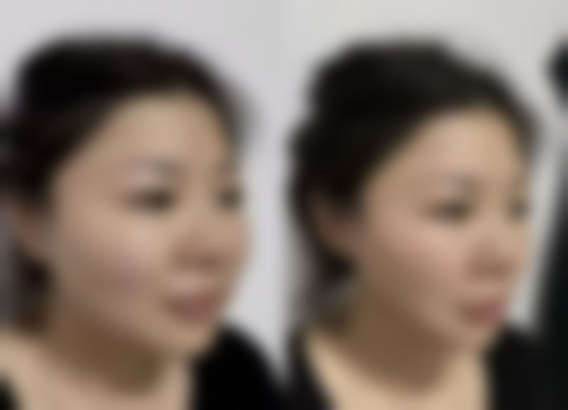 昆山米扬丽格医疗美容口碑评价