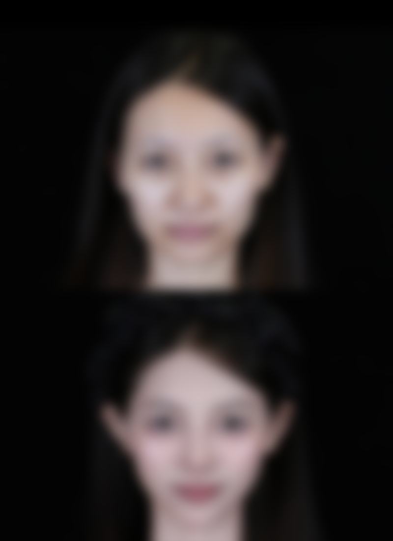 合肥汇美丛生医疗美容诊所治疗反馈与口碑评价。