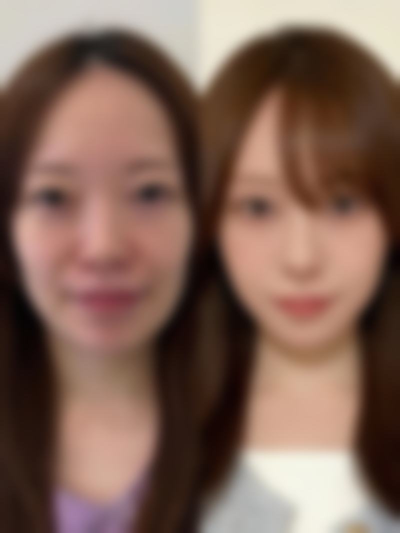 长春华医美容整形门诊部治疗反馈与口碑评价。