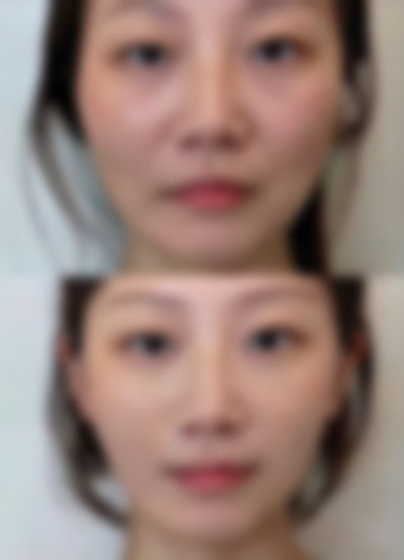 天津妍希医疗美容诊所擅长项目