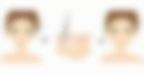 沈阳铁西美树整形医院医生团队经验稳定。
