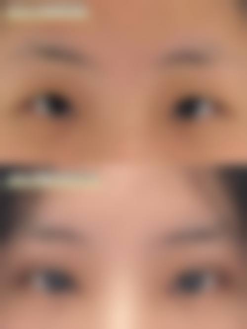 深圳联合丽格蓝楹湾医疗美容诊所擅长项目。