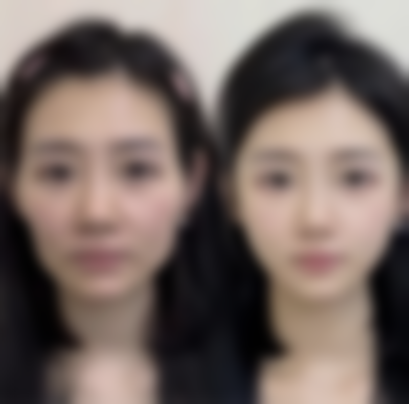 西安御美整形医院擅长项目
