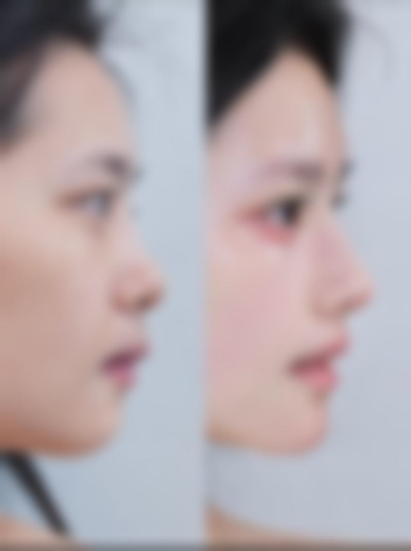潍坊博雅医疗美容门诊部口碑评价