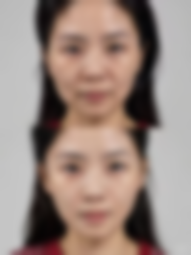 榆林天一灵性医疗美容诊所王承发医生技术怎么样