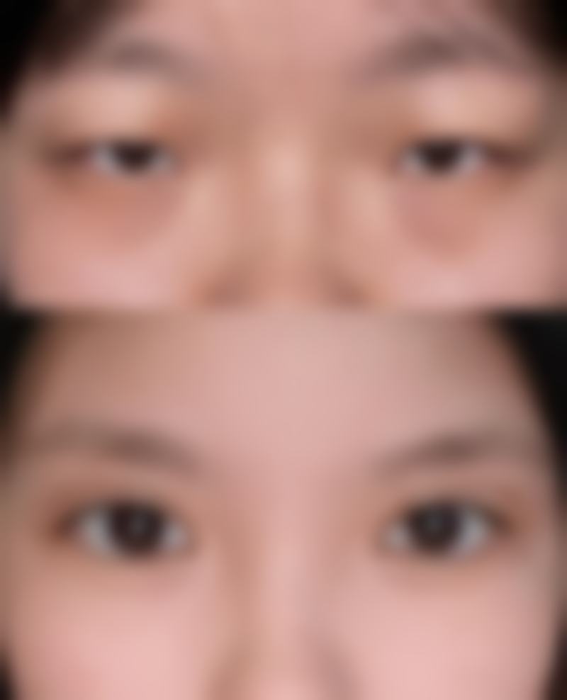株洲艺佳医疗美容专科医院擅长项目。