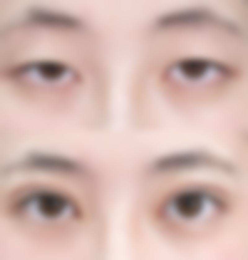 株洲艺佳医疗美容专科医院治疗反馈与口碑评价。