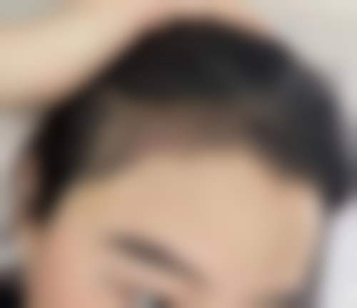 盐城美芭整形医院擅长项目