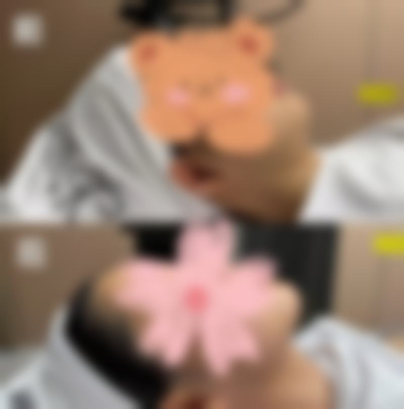 深圳西诺医学美容机构擅长项目。