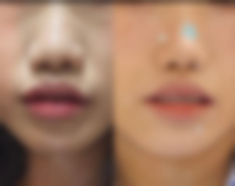 西安梦之梦美人姬美容诊所擅长项目。