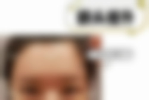 卓宽哲医生的技术实力