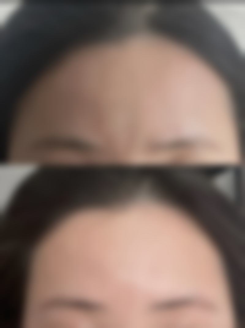 深圳舒特绮医疗美容诊所项目价格