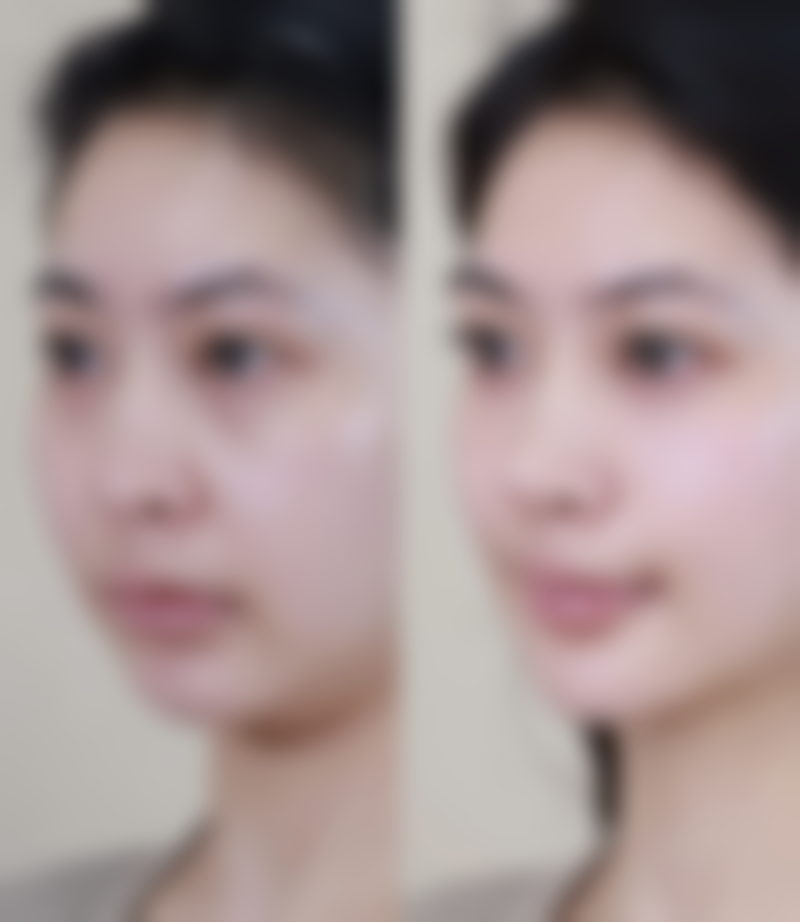 沈阳云惠美医疗美容门诊医生团队经验稳定。