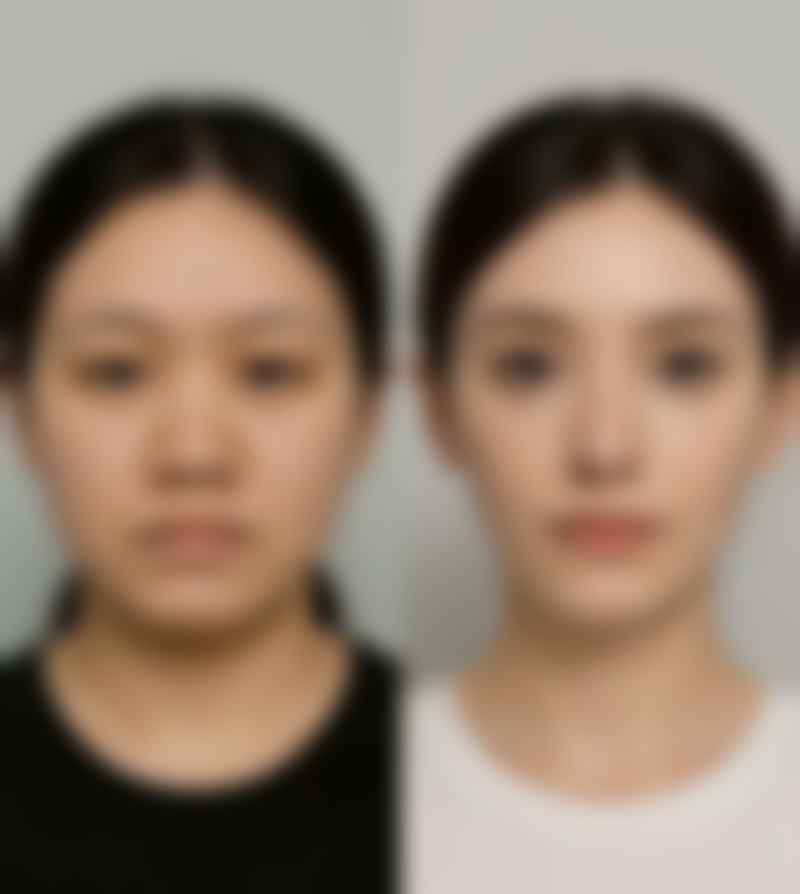阳泉迪美医疗美容诊所治疗反馈与口碑评价。