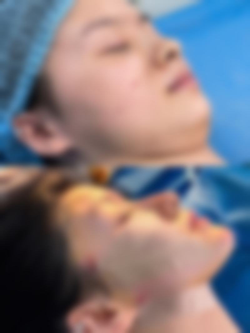南昌西湖你好美整形医院擅长项目。