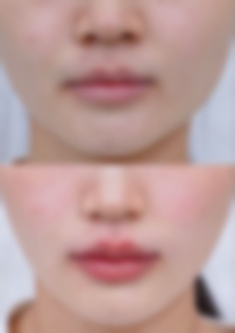 南宁美初医疗美容门诊部的口碑评价
