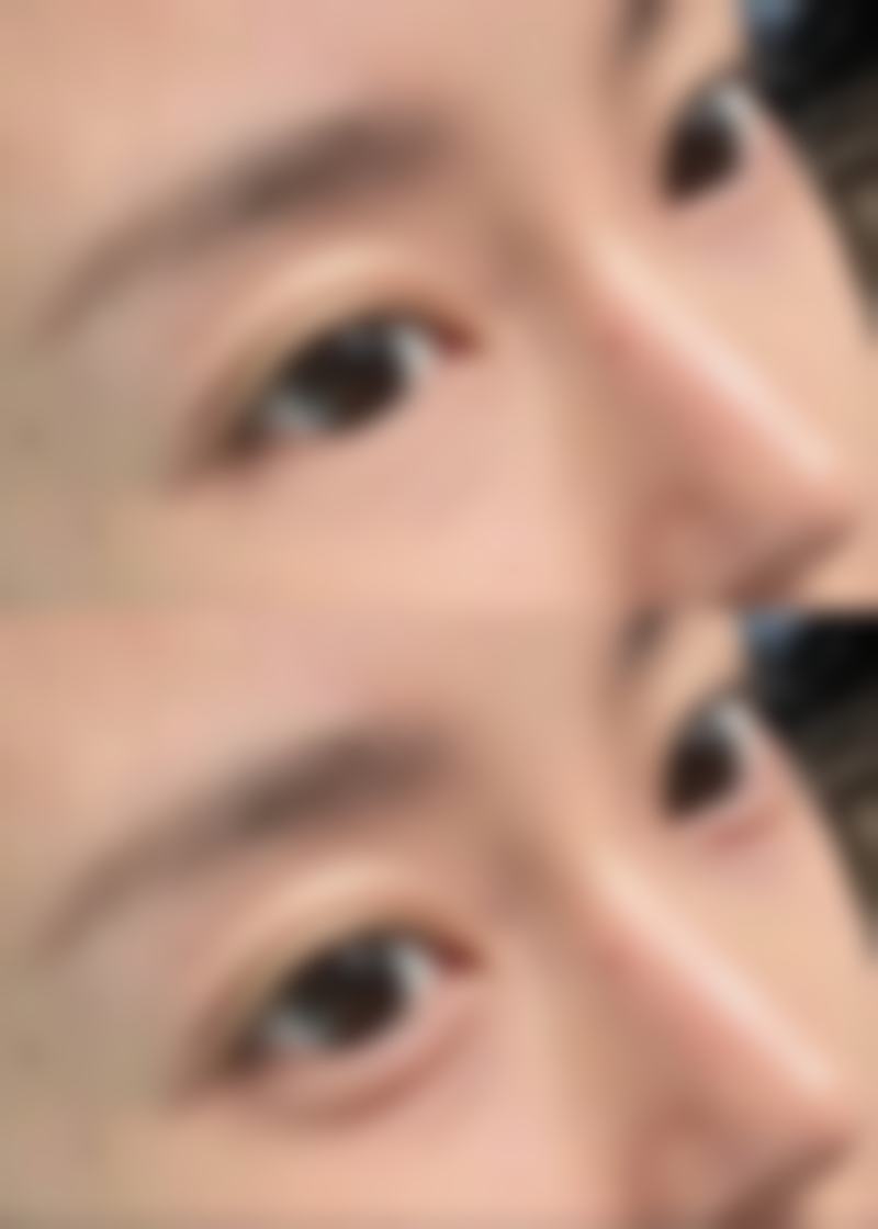 清远华美整形擅长项目。