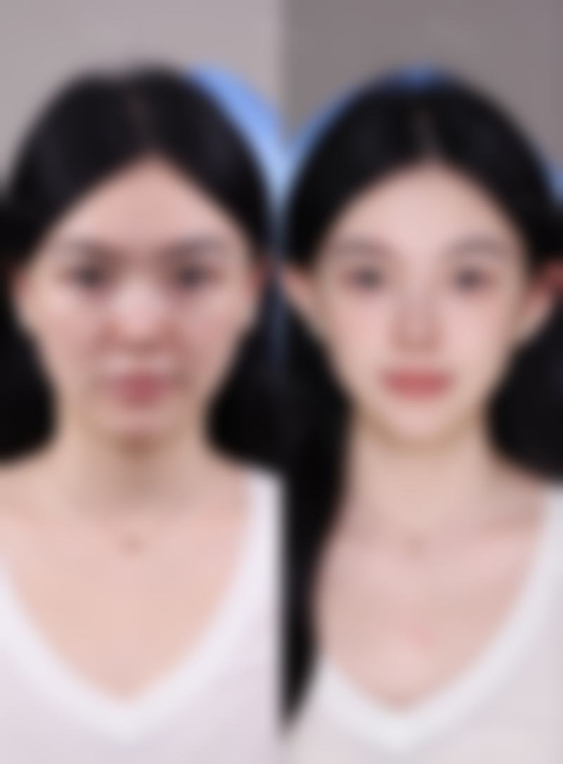 宁夏银川慧清雅妍医疗美容门诊部医生团队经验稳定。