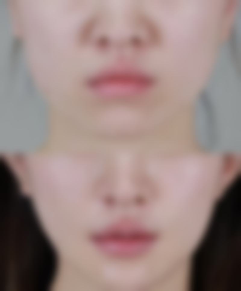 东莞植德医疗美容门诊部医生团队经验稳定。
