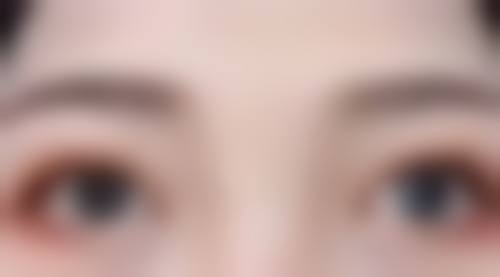 忻州美神整形美容门诊部治疗反馈与口碑评价。