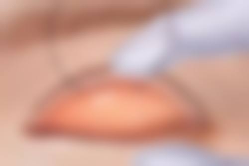 东莞现代女子医疗美容诊所医生团队经验稳定。