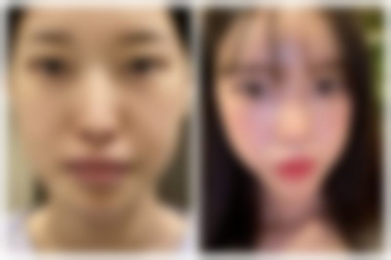 兰州华年医疗美容诊所擅长项目。