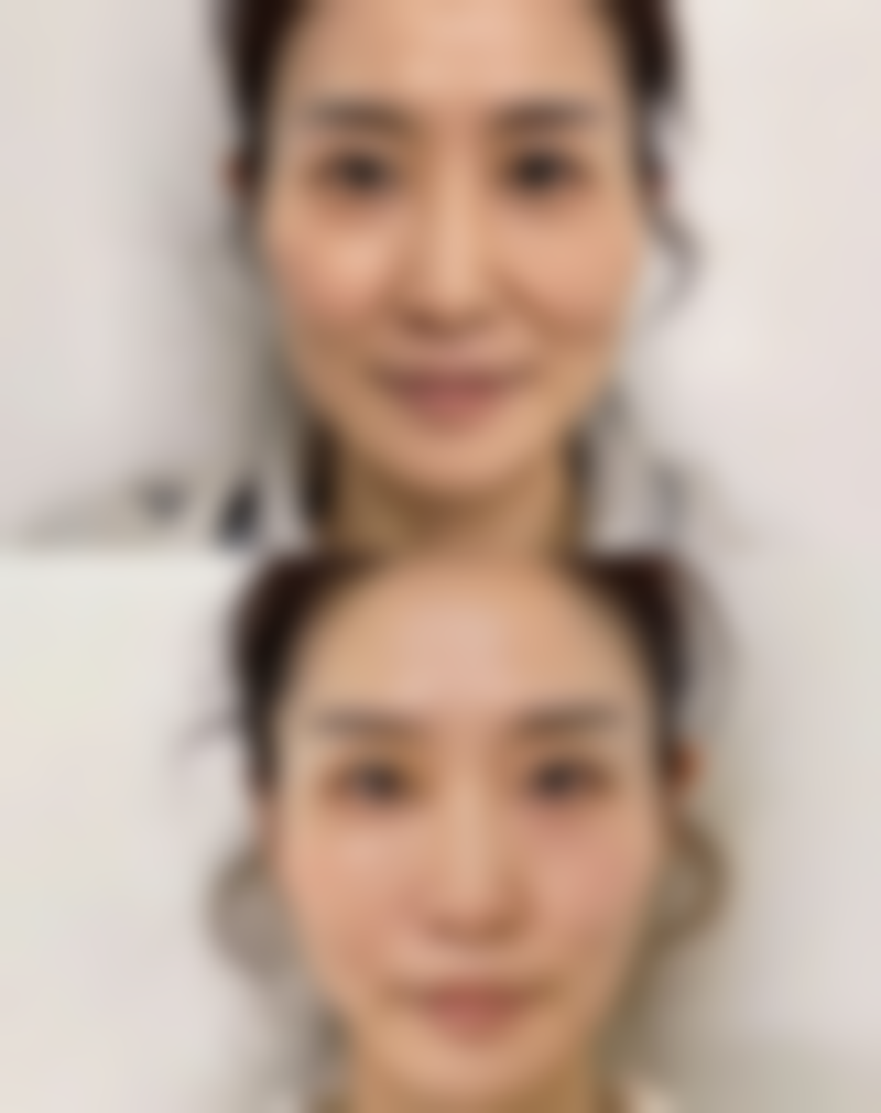 淮南华美整形美容门诊部治疗反馈与口碑评价。