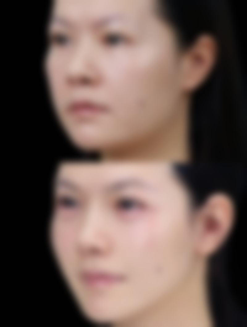 海口熙颜医疗美容门诊部治疗反馈与口碑评价。