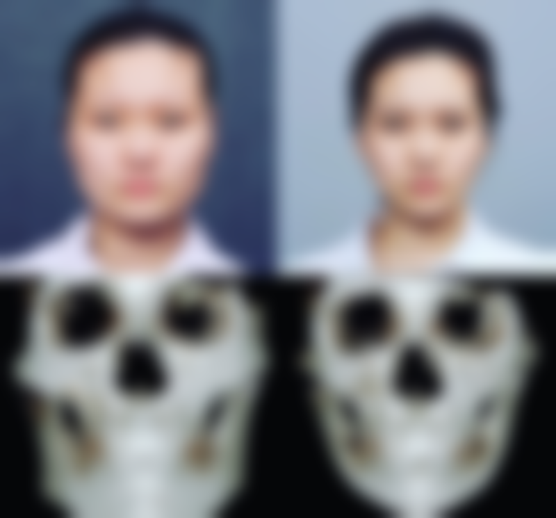 无锡艾谜整形医院预约方式