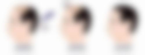 宁波卓美整形医院乘车路线：