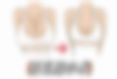 深圳玉颜堂医疗美容门诊部擅长项目。