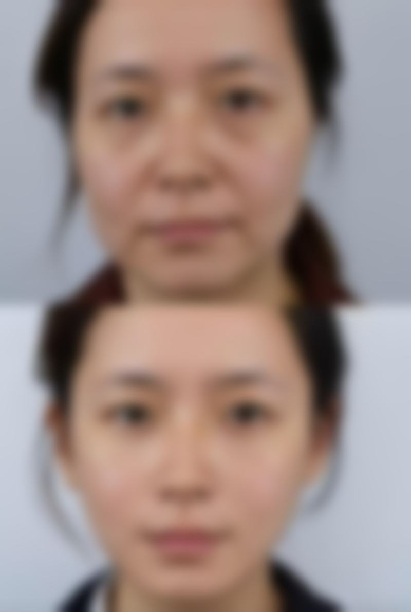 韩国李韩率整形外科上班时间:
