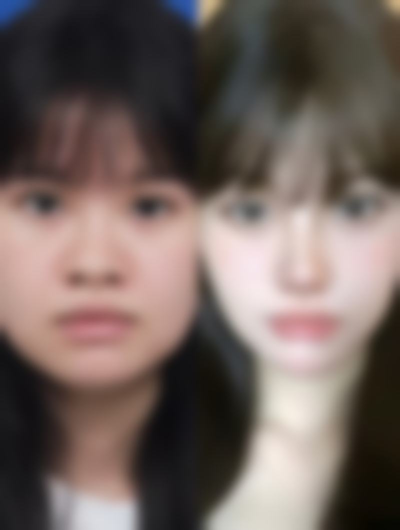深圳玉颜堂医疗美容门诊部特色项目展示