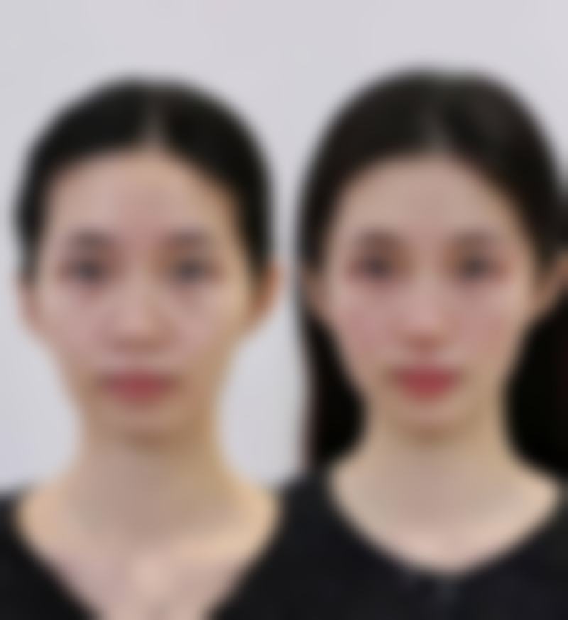 郑州帝尔美整形医院胡茜医生技术怎么样