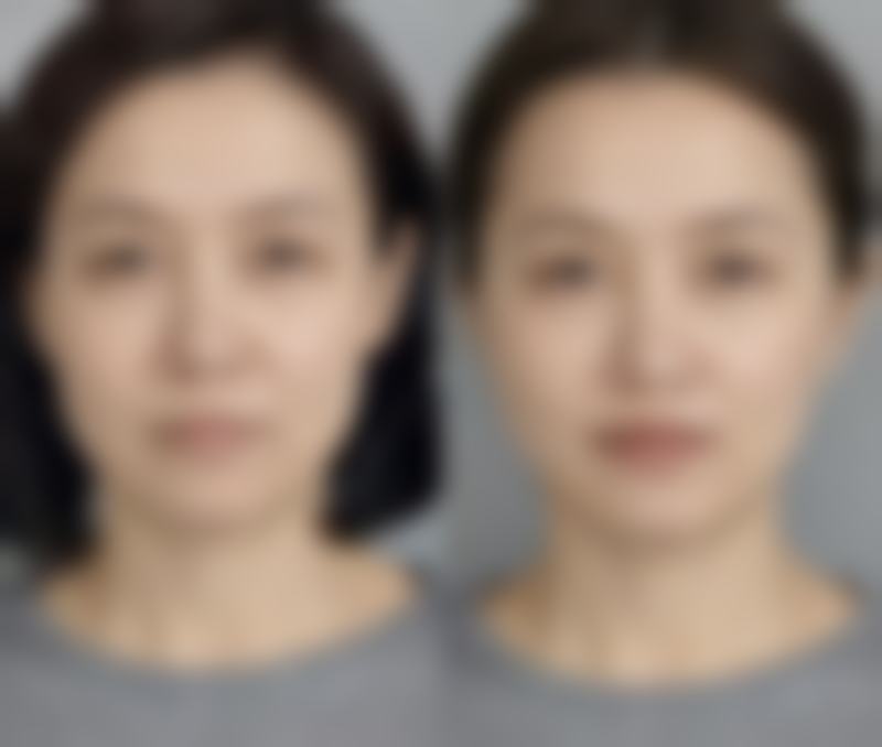 深圳悦颜医疗美容门诊部口碑评价与项目分享:
