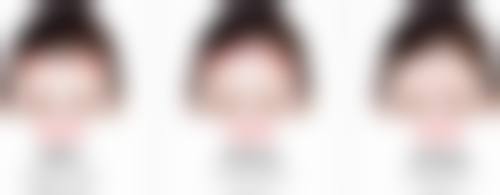 张晓鸿医生的技术实力