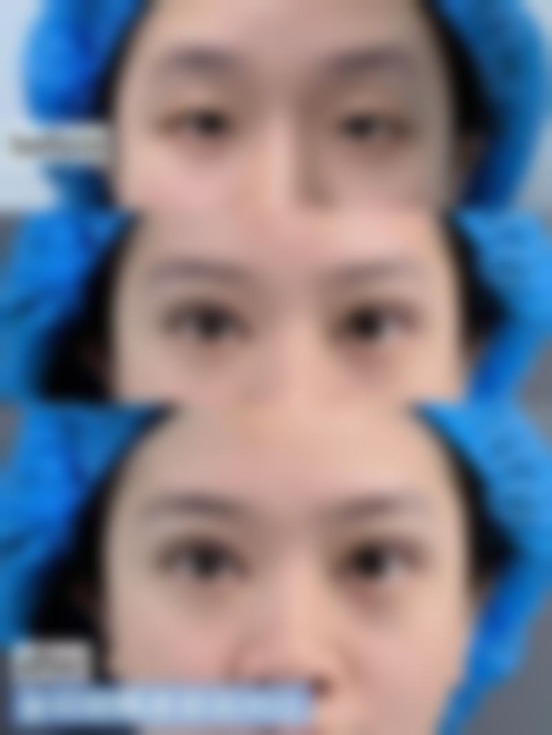 福州林潮医生眼部整形工作室乘车路线: