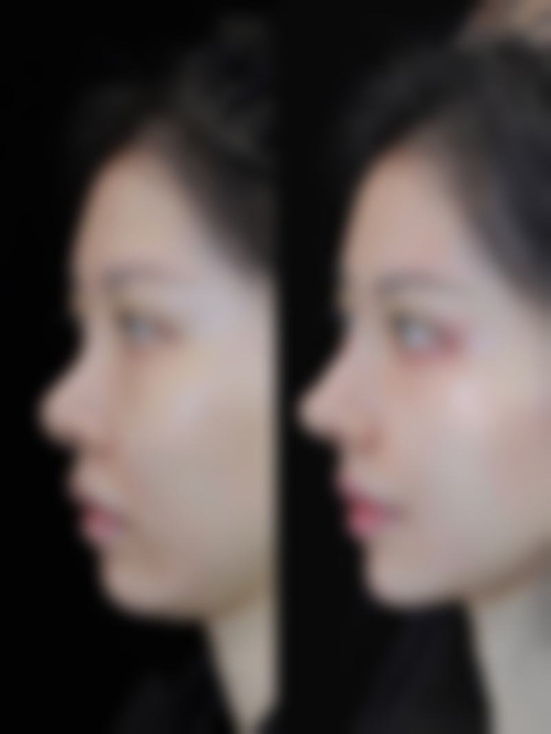 渭南柏优医疗美容医院上班时间: